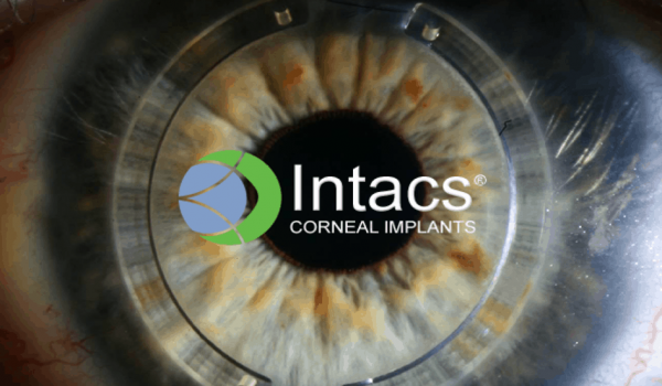Intacs-corneal-implants